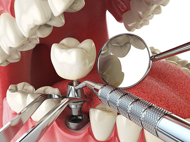 Best Mobile Emergency Dentist in Walkerton, IN